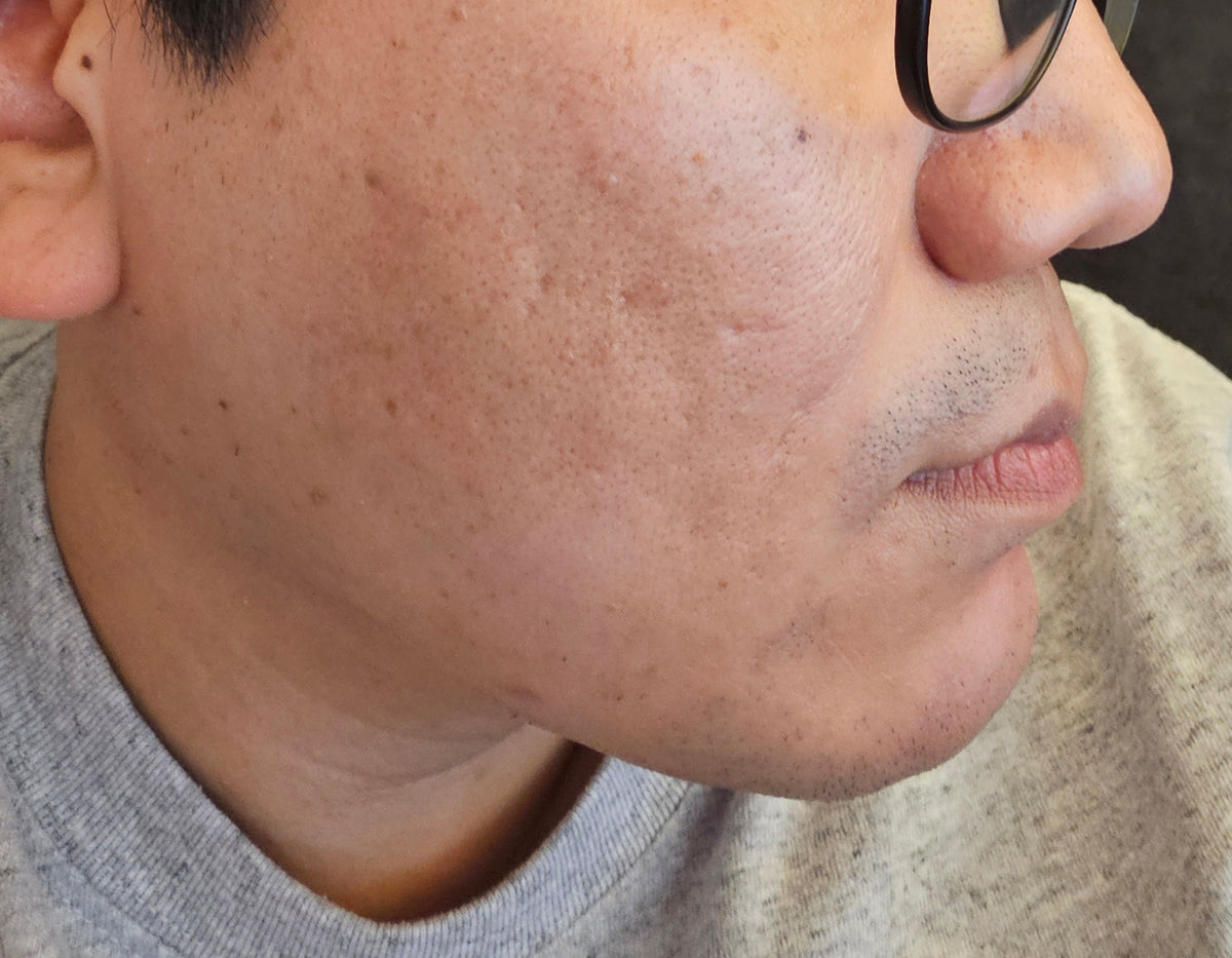 Blion:Cell Azulene Cica Ampoule from Korea